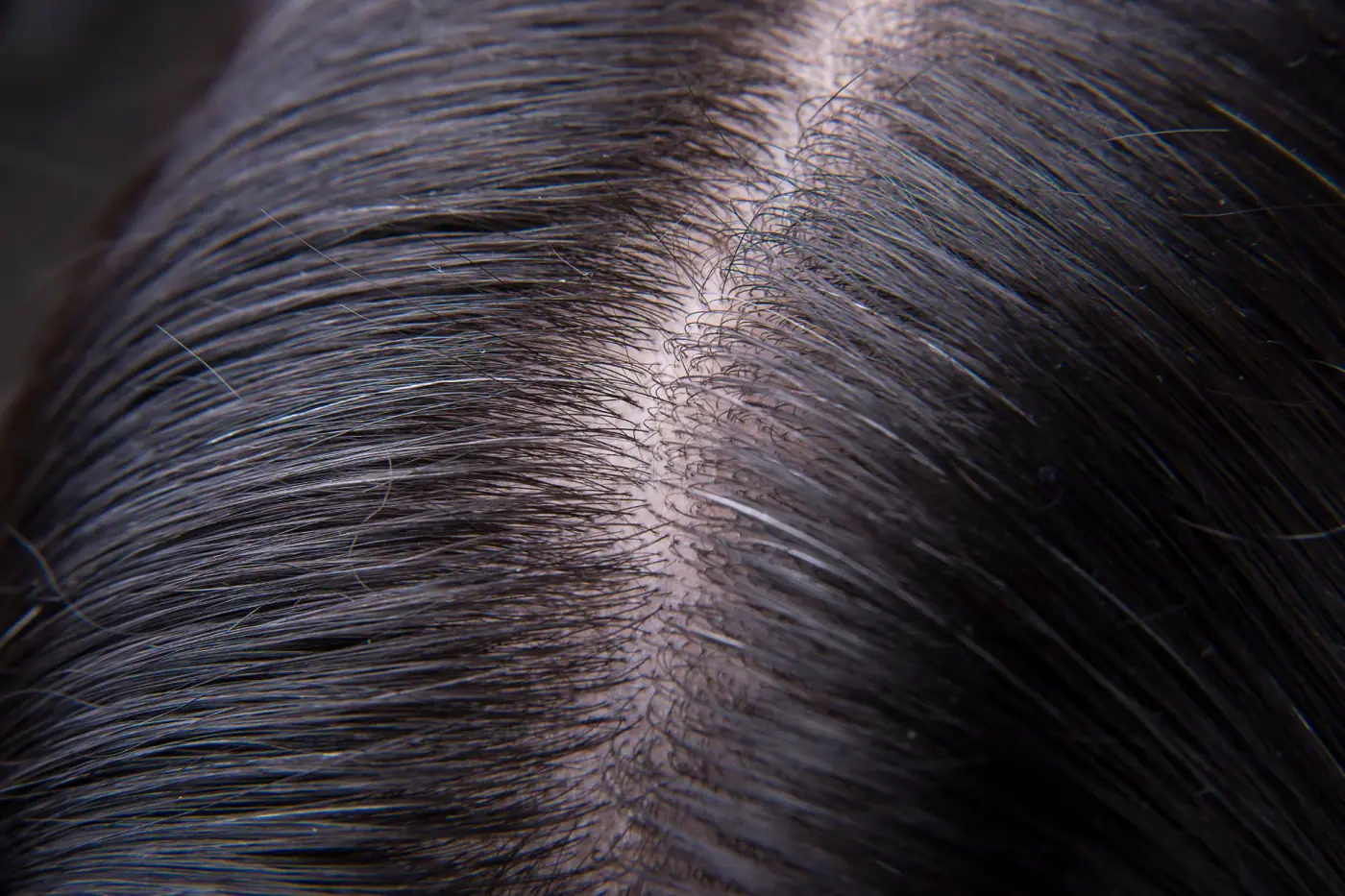 Close view of a parted scalp, shown to illustrate hair care