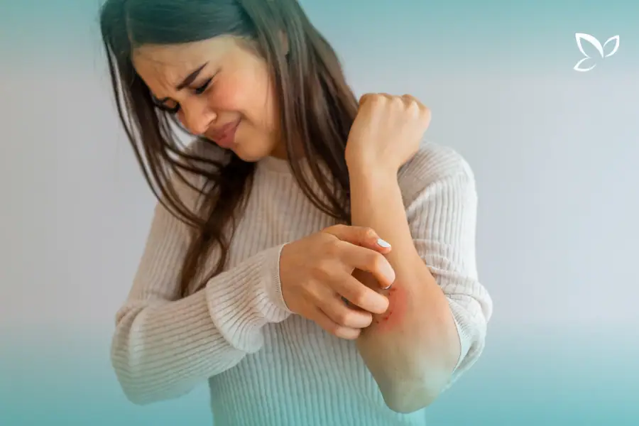 Woman scratching a red patch on her forearm