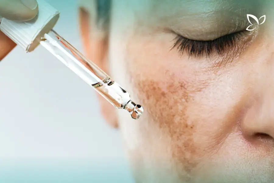 Dropper held beside brown patches on a cheek